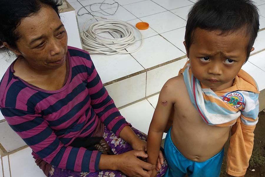 Lengan Bocah Di Gigit Anjing Rabies Balipost Com