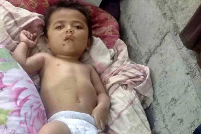 Sempat Kejang Kemudian Mati Suri, Balita Ciltabi Kini Alami Hydrocephalus 1 kejang