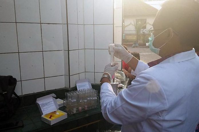 BBPOM Lakukan Pengawasan Takjil di Klungkung 1