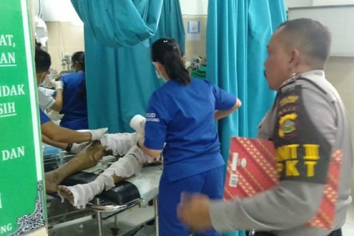 Ngaben di Setra Desa Negari, Kompor Sebabkan 4 Orang Luka Bakar Serius 1