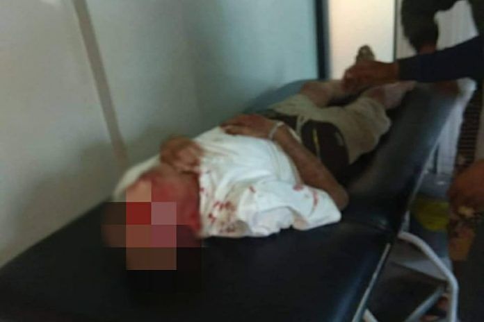 Tabrak Pohon Tumbang, Pemotor Alami Luka di Kepala 1