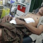 Kakak-beradik Terlibat Duel di Halaman Rumah, Satu Terluka di Perut