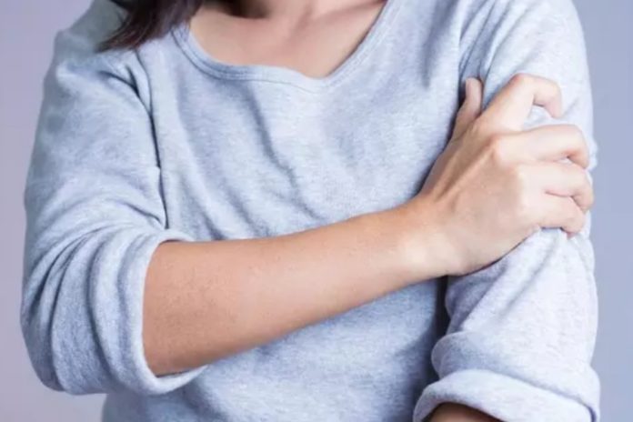 Ini, 8 Pengobatan Rematik Untuk Redakan Gejalanya 1