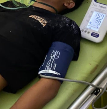 Jatuh dari Pohon Juwet, Remaja Asal Pejarakan Tewas