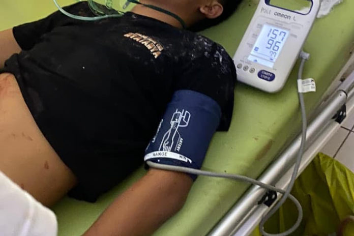 Jatuh Dari Pohon Juwet, Remaja Asal Pejarakan Tewas 1