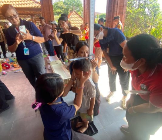 SGGI Sebut Angka Stunting Denpasar 10,4 Persen, Dinkes Lakukan Pengukuran Serentak