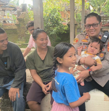 Polsek Tegallalang Bantu Keluarga Balita Penderita Bibir Sumbing di Desa Kedisan