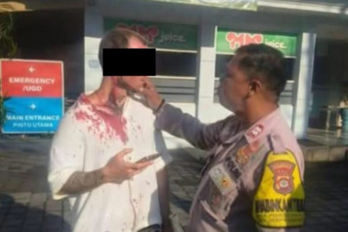 Pukul Warga Hingga Terluka Di Tempat Gym, WN Asal Prancis Diamankan 1