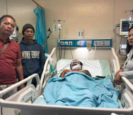 Pelaku Penusukan di Desa Les Resmi Jadi Tersangka, Korban Masih Dirawat di ICU