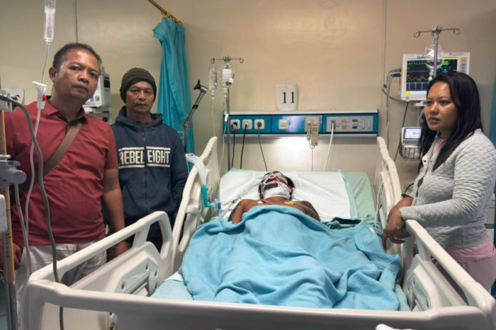Pelaku Penusukan Di Desa Les Resmi Jadi Tersangka, Korban Masih Dirawat Di ICU 1