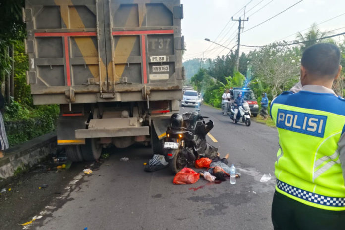 Tabrak Pantat Truk Tronton Saat Ditinggal BAB, Pemotor Pasutri Alami Luka Parah 1