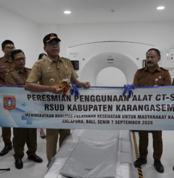 Tingkatkan Pelayanan Kesehatan, Bupati Gus Par Launching CT Scan 64 Slices di RSUD Karangasem