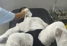 Usai Jalani Operasi, Sopir yang Dibakar Bosnya Meninggal Dunia
