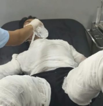 Usai Jalani Operasi, Sopir yang Dibakar Bosnya Meninggal Dunia