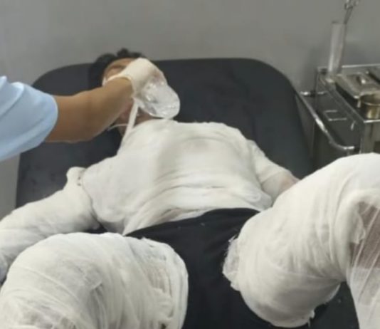 Usai Jalani Operasi, Sopir yang Dibakar Bosnya Meninggal Dunia