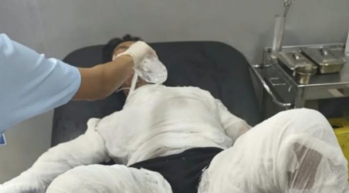 Usai Jalani Operasi, Sopir yang Dibakar Bosnya Meninggal Dunia