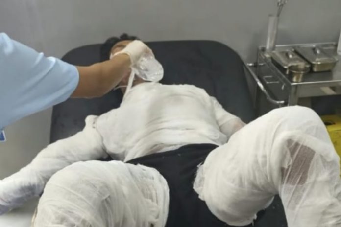 Usai Jalani Operasi, Sopir Yang Dibakar Bosnya Meninggal Dunia 1