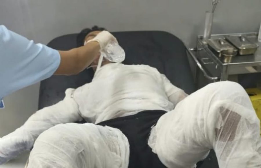 Usai Jalani Operasi, Sopir yang Dibakar Bosnya Meninggal Dunia